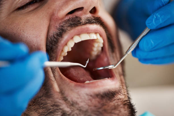 Best Emergency Tooth Extraction in Winfield, TN